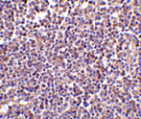 Immunohistochemistry - AIM Antibody from Signalway Antibody (24415) - Antibodies.com