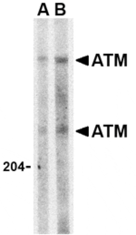 Western blot - ATM Antibody from Signalway Antibody (24457) - Antibodies.com