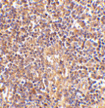 Immunohistochemistry - ATM Antibody from Signalway Antibody (24457) - Antibodies.com