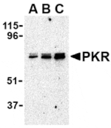 Western blot - PKR Antibody from Signalway Antibody (24458) - Antibodies.com