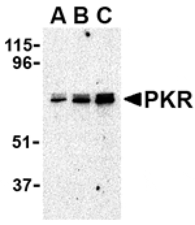 Western blot - PKR Antibody from Signalway Antibody (24458) - Antibodies.com