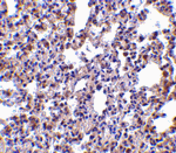 Immunohistochemistry - PKR Antibody from Signalway Antibody (24458) - Antibodies.com