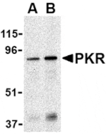 Western blot - PKR Antibody from Signalway Antibody (24459) - Antibodies.com