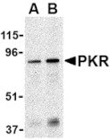 Western blot - PKR Antibody from Signalway Antibody (24459) - Antibodies.com