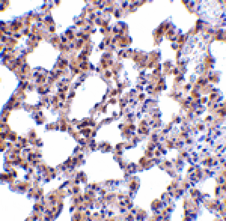 Immunohistochemistry - PKR Antibody from Signalway Antibody (24459) - Antibodies.com