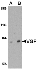 Western blot - VGF Antibody from Signalway Antibody (24686) - Antibodies.com