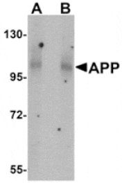 Western blot - APP Antibody from Signalway Antibody (24877) - Antibodies.com