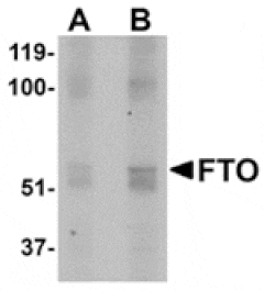 Western blot - FTO Antibody from Signalway Antibody (24880) - Antibodies.com