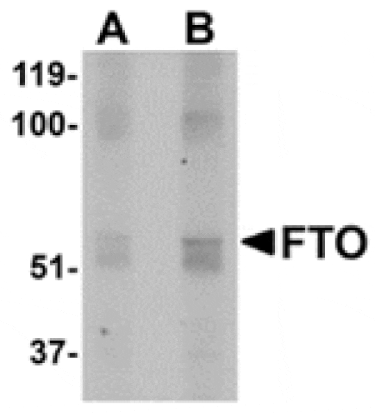 Western blot - FTO Antibody from Signalway Antibody (24880) - Antibodies.com