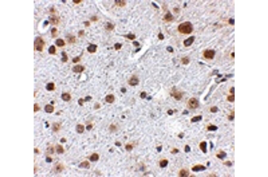 Immunohistochemistry - FTO Antibody from Signalway Antibody (24880) - Antibodies.com