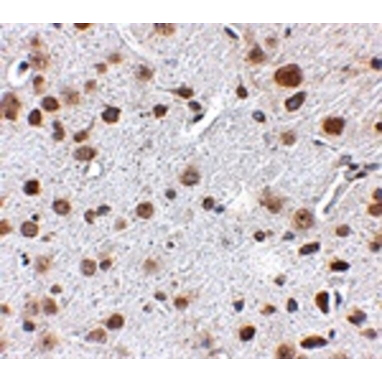 Immunohistochemistry - FTO Antibody from Signalway Antibody (24880) - Antibodies.com