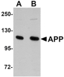 Western blot - APP Antibody from Signalway Antibody (24883) - Antibodies.com