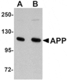 Western blot - APP Antibody from Signalway Antibody (24883) - Antibodies.com