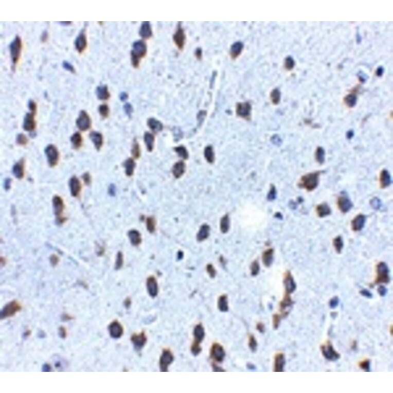 Immunohistochemistry - SCF Antibody from Signalway Antibody (24894) - Antibodies.com