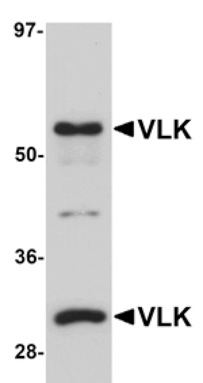 Western blot - VLK Antibody from Signalway Antibody (25033) - Antibodies.com