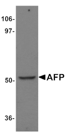 Western blot - AFP Antibody from Signalway Antibody (25163) - Antibodies.com