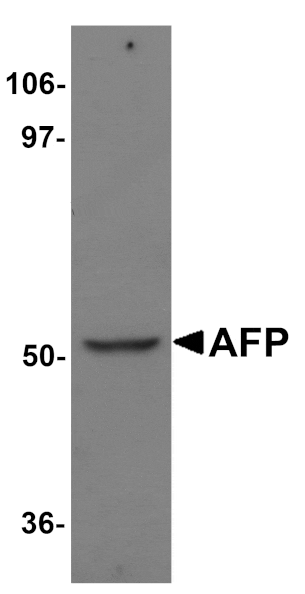 Western blot - AFP Antibody from Signalway Antibody (25163) - Antibodies.com