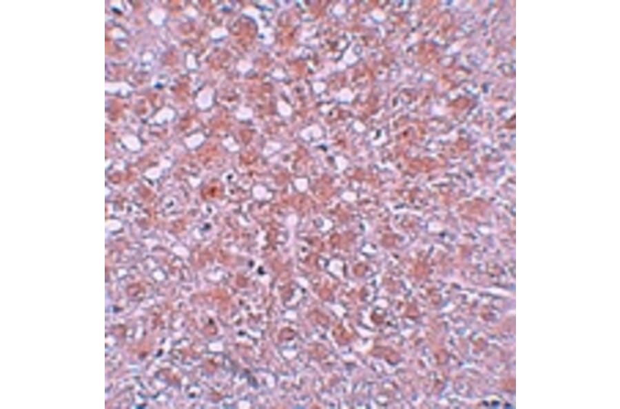 Immunohistochemistry - AFP Antibody from Signalway Antibody (25163) - Antibodies.com