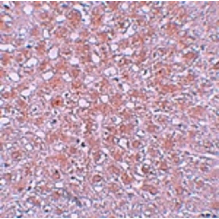 Immunohistochemistry - AFP Antibody from Signalway Antibody (25163) - Antibodies.com