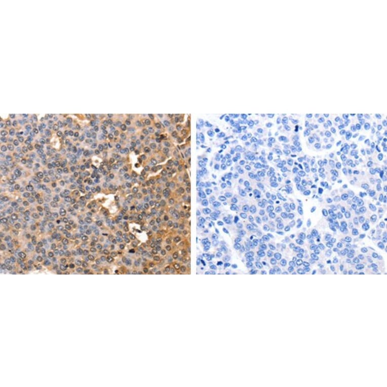 AFP Antibody from Signalway Antibody (31001) - Antibodies.com