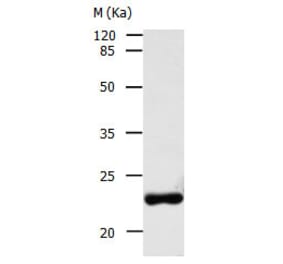 AK1 Antibody from Signalway Antibody (31027) - Antibodies.com