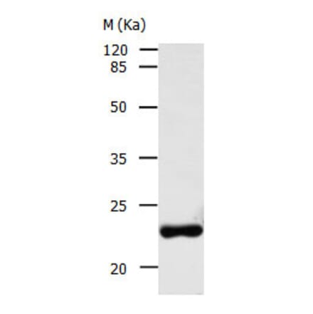 AK1 Antibody from Signalway Antibody (31027) - Antibodies.com