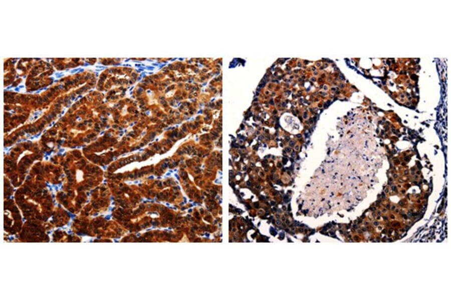AK1 Antibody from Signalway Antibody (31027) - Antibodies.com