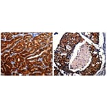 AK1 Antibody from Signalway Antibody (31027) - Antibodies.com