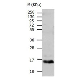 TTR Antibody from Signalway Antibody (31034) - Antibodies.com