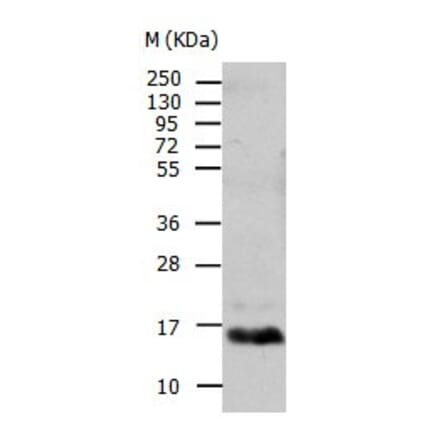TTR Antibody from Signalway Antibody (31034) - Antibodies.com