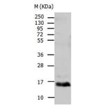 TTR Antibody from Signalway Antibody (31034) - Antibodies.com