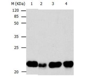 BID Antibody from Signalway Antibody (31037) - Antibodies.com