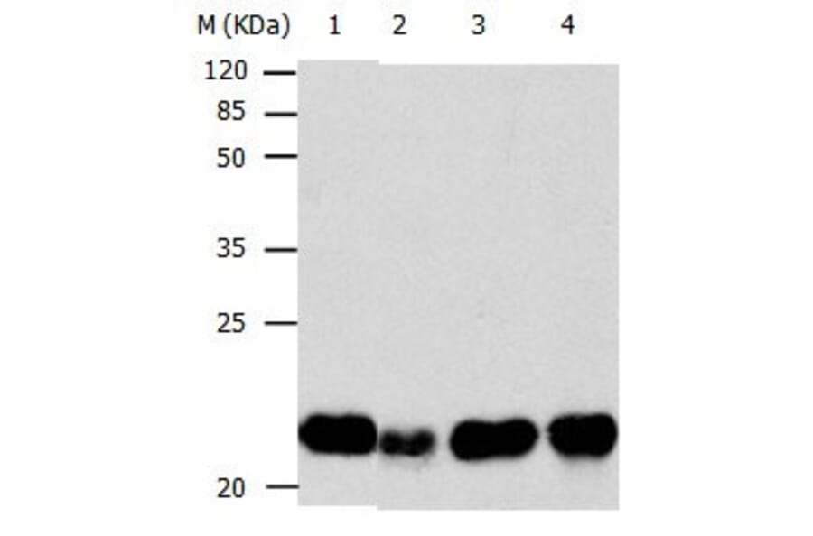 BID Antibody from Signalway Antibody (31037) - Antibodies.com