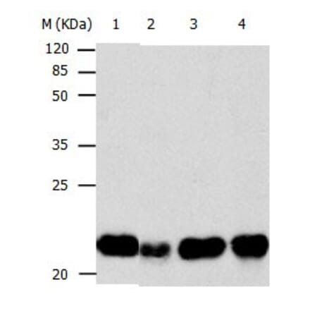 BID Antibody from Signalway Antibody (31037) - Antibodies.com