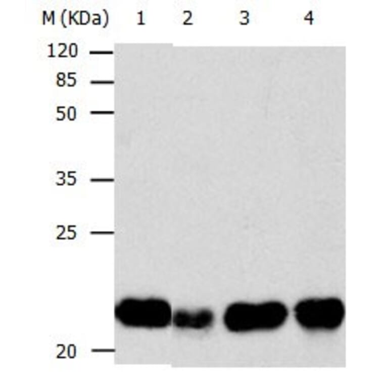 BID Antibody from Signalway Antibody (31037) - Antibodies.com