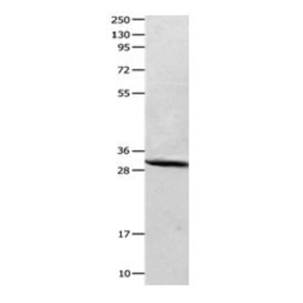 CA2 Antibody from Signalway Antibody (31044) - Antibodies.com