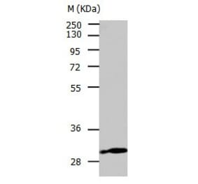 CA3 Antibody from Signalway Antibody (31045) - Antibodies.com