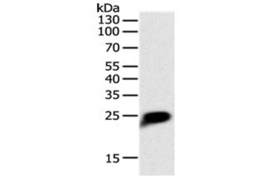 CRP Antibody from Signalway Antibody (31062) - Antibodies.com