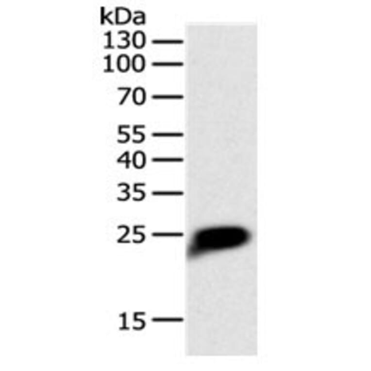 CRP Antibody from Signalway Antibody (31062) - Antibodies.com
