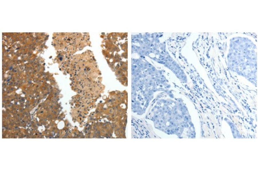 CRP Antibody from Signalway Antibody (31062) - Antibodies.com