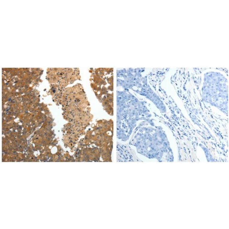 CRP Antibody from Signalway Antibody (31062) - Antibodies.com