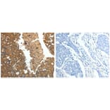 CRP Antibody from Signalway Antibody (31062) - Antibodies.com