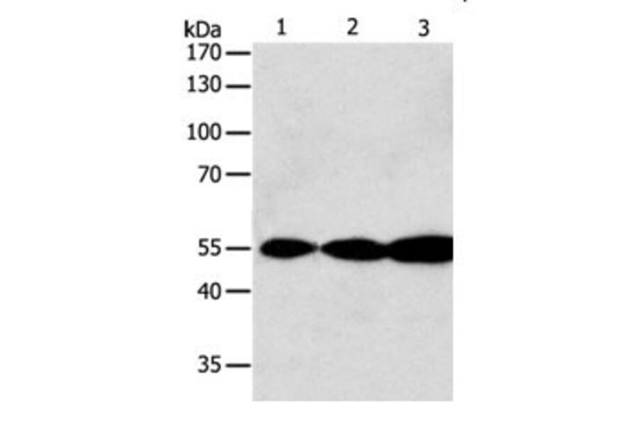 GSR Antibody from Signalway Antibody (31078) - Antibodies.com
