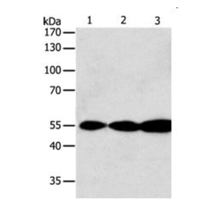 GSR Antibody from Signalway Antibody (31078) - Antibodies.com