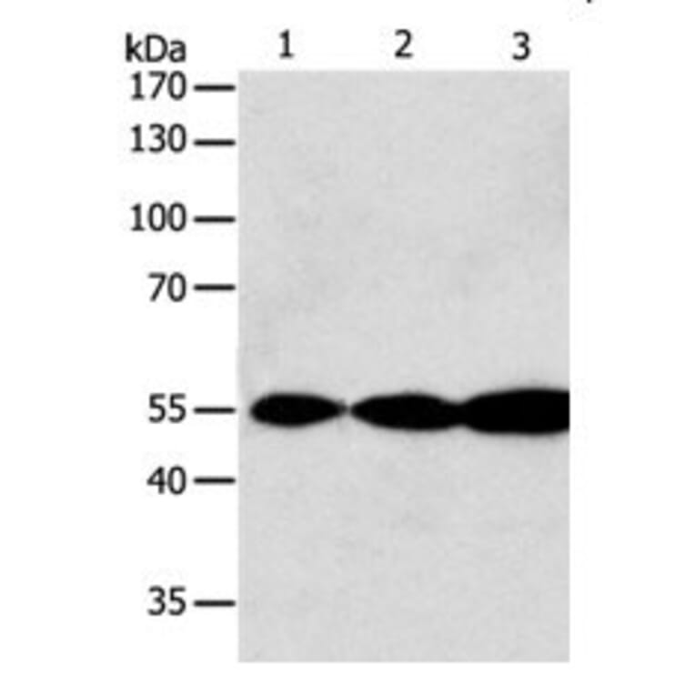 GSR Antibody from Signalway Antibody (31078) - Antibodies.com