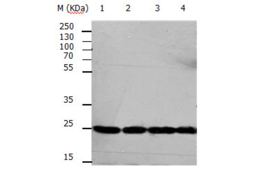 RAN Antibody from Signalway Antibody (31155) - Antibodies.com