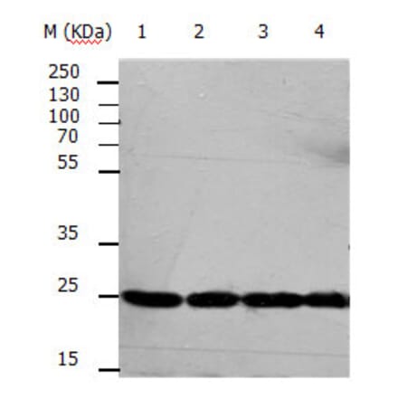 RAN Antibody from Signalway Antibody (31155) - Antibodies.com
