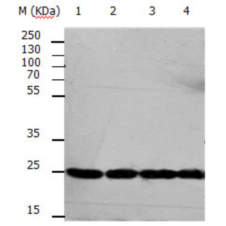 RAN Antibody from Signalway Antibody (31155) - Antibodies.com