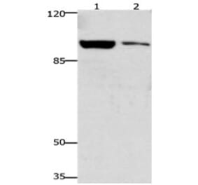 GSN Antibody from Signalway Antibody (31204) - Antibodies.com