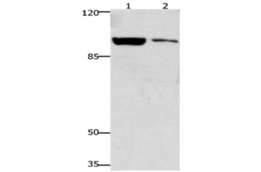 GSN Antibody from Signalway Antibody (31204) - Antibodies.com